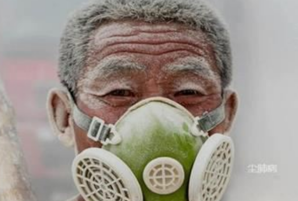 尘肺病的治疗方法