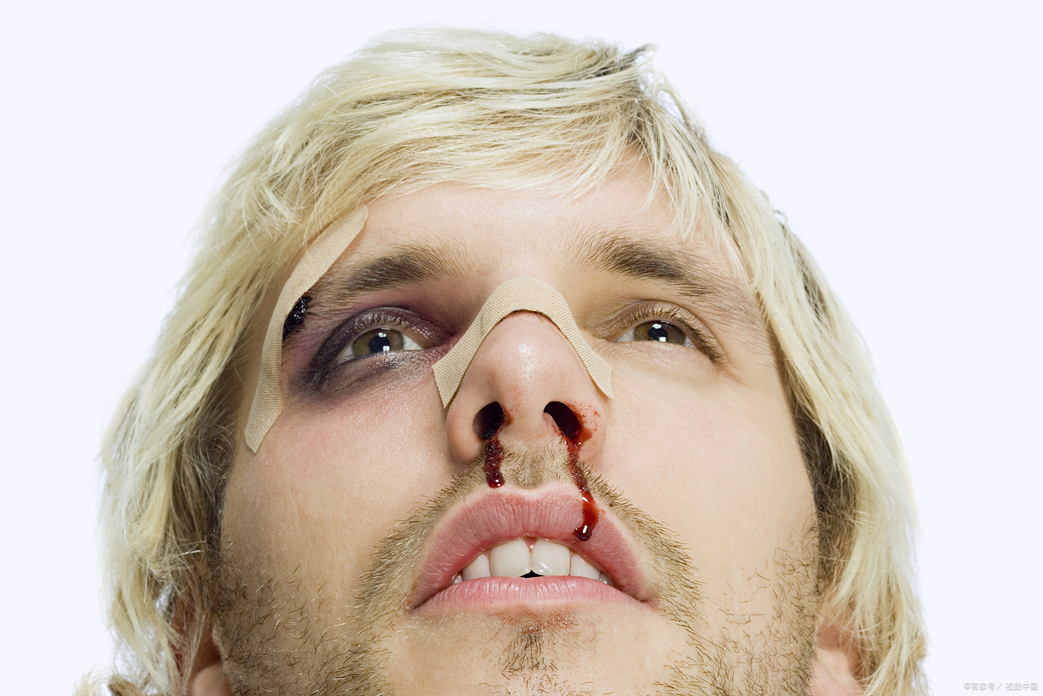 创伤后应激反应是什么,我们该如何对待?