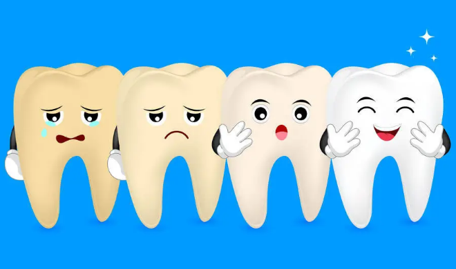 牙齿美白要多少钱