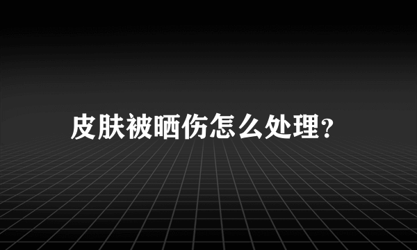 皮肤被晒伤怎么处理？