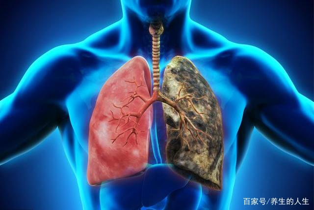 肺癌的早期症状和前兆,你知道的都有哪些?
