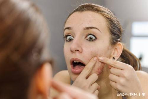 脸上的黑色痘印怎么才能快速消下去啊