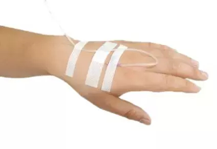 马铃薯有哪些营养价值?