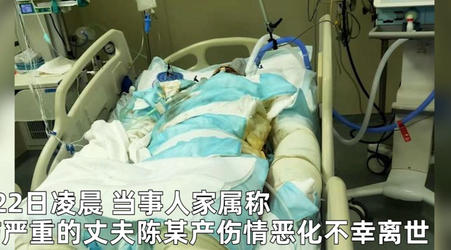 南京火灾中舍身救妻的丈夫去世,全身多数烧伤的存活率有多高?