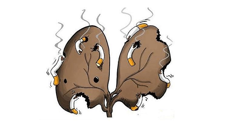 肺癌的早期症状和前兆,你知道的都有哪些?