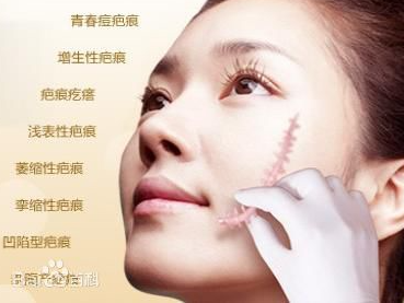 疤克是什么?是干什么的啊!!