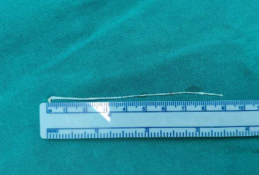 1厘米,等于多少毫米