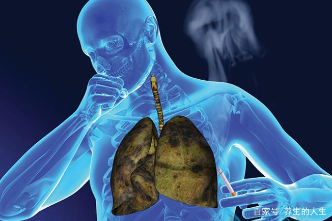肺癌的早期症状和前兆,你知道的都有哪些?
