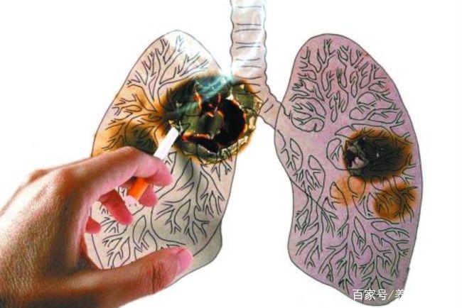 肺癌的早期症状和前兆,你知道的都有哪些?