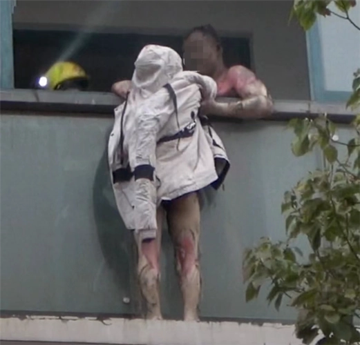 南京火灾中舍身救妻的丈夫去世,全身多数烧伤的存活率有多高?