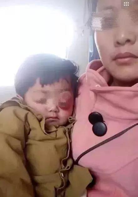 媒体如何评小凤雅去世问题的?