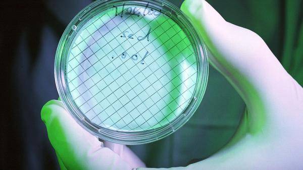 自来水遭致命微型变形虫入侵，这种生物会造成什么影响？