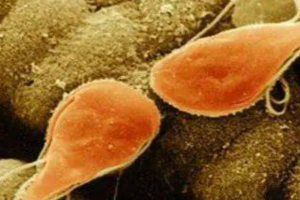 美国现可怕的“食脑虫”,这种虫子会传染吗?
