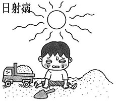 酷暑天在家“闷”出热射病,热射病到底有多要命?