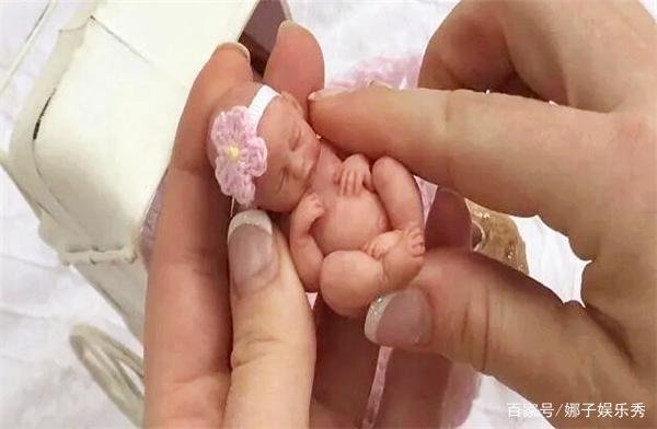 现实版拇指姑娘，出生时只有25厘米打破世界纪录，现状如何？