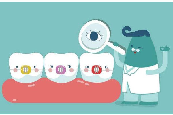 箍牙一般多少钱