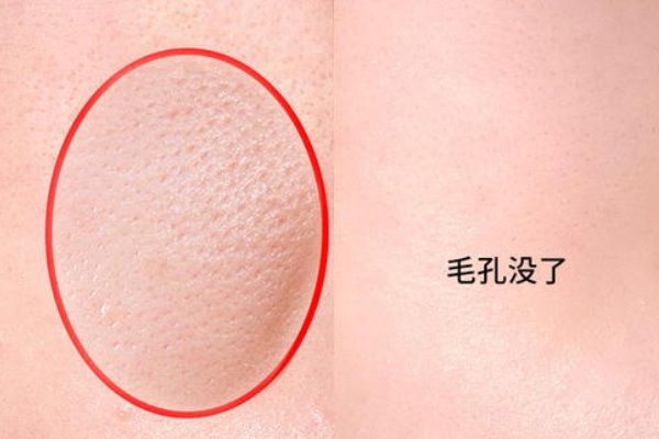 什么面膜能收缩毛孔呢?