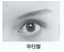 双眼皮到底有几种类型？