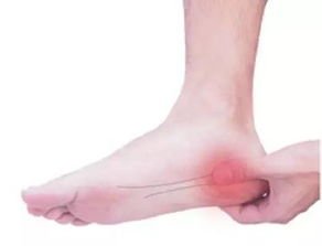 如何治疗脚跟的骨刺、骨质增生？有什么办法？