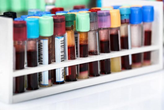 blood是什么意思,血液翻译