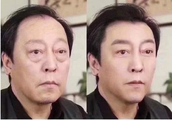 眼袋和卧蚕的区别。。