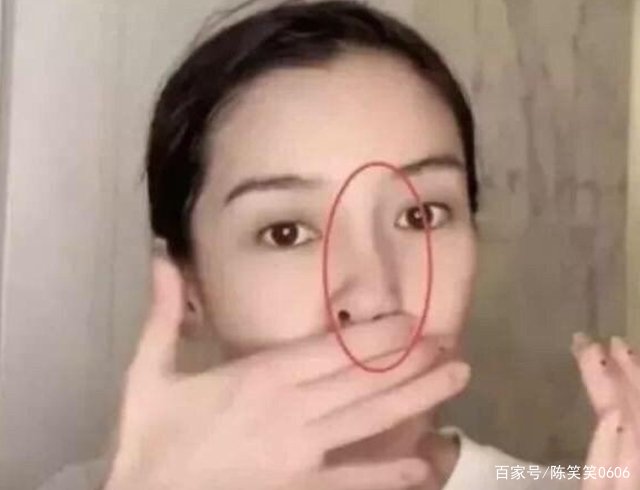 杨幂假屁股被群嘲,鞠婧祎装傻遭热议,baby鼻子歪了后来怎样了?