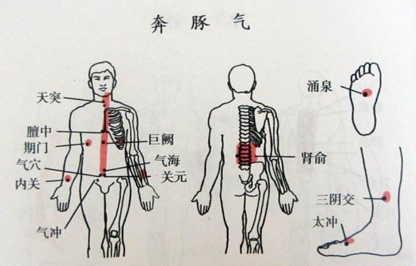 奔豚症到底是啥？仔细辩证，一剂知二剂已呢？