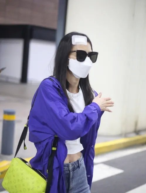 黄圣依拍戏时头部受伤，受伤情况如何，严重吗？