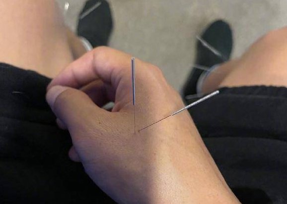 邓超吐槽带孩子针灸被扎14针,网友们都是如何调侃邓超的?