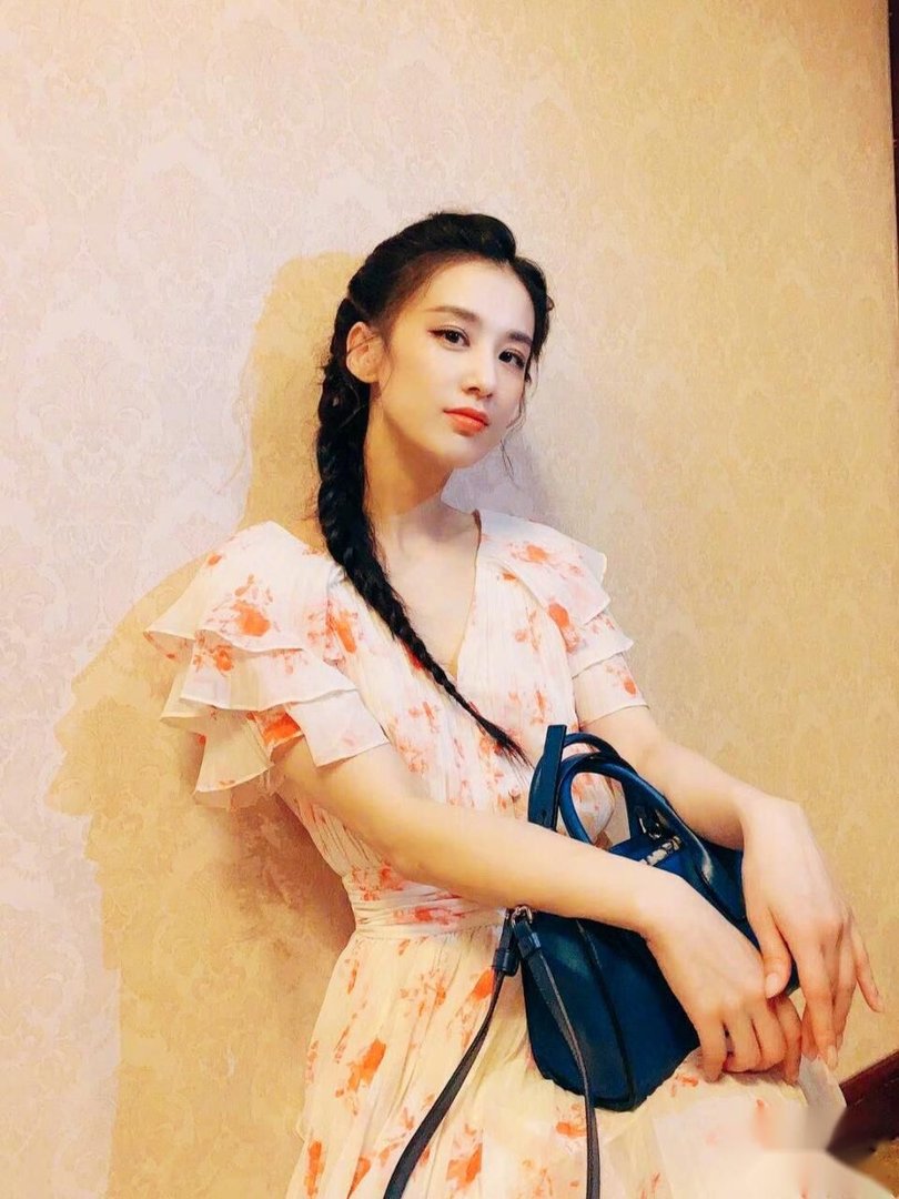 黄圣依拍戏时头部受伤,受伤情况如何,严重吗?