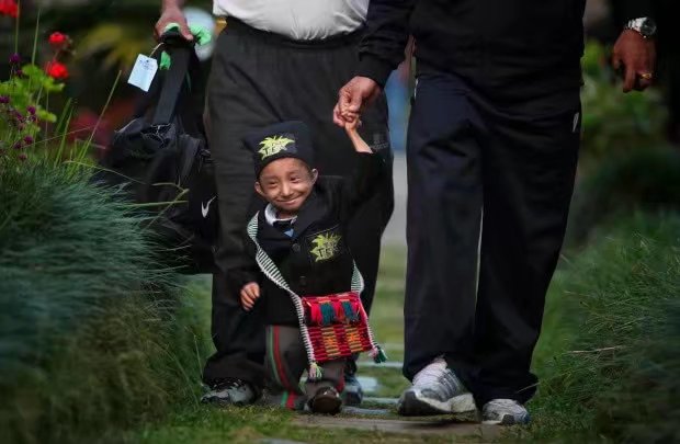 世界上最矮的人是谁?