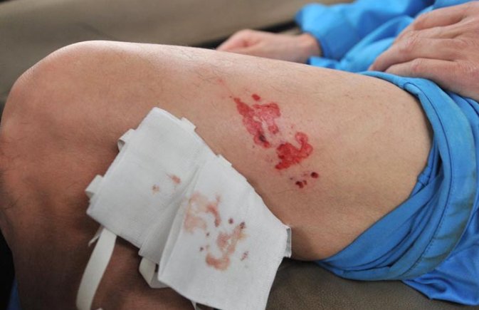 安阳市政府办回应“狗咬伤老人”事件,都说了什么?