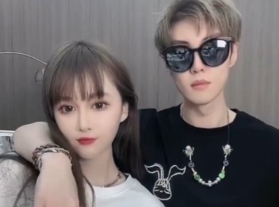 赵本山女儿球球秀恩爱,男方全程口罩遮脸,男方脖子上的细节你注意到了吗?