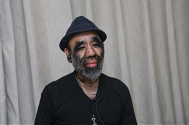 “毛孩”于震寰轰动一时，曾和十位护士相亲，现在他怎样了？