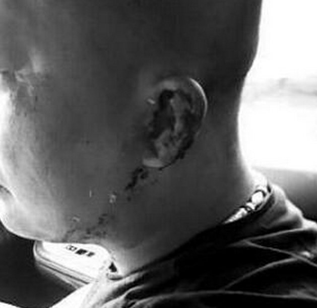 打假者维权不成被围殴导致身体多处骨折？