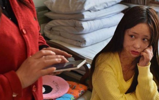 十六岁少女周岩,因拒绝追求惨遭毁容,现在怎么样了?