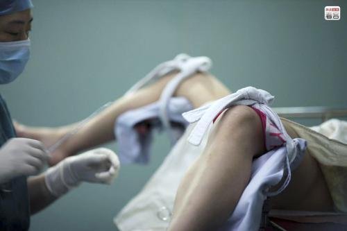 做药流最佳时间是多少天