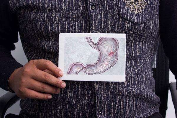 什么是胃肠道息肉？人为什么会长息肉？