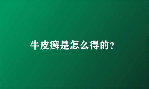 牛皮癣是怎么得的?