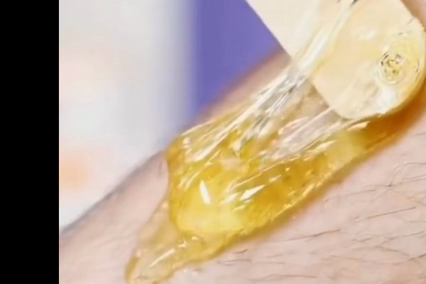 男士脱毛方法;不知道用什么啊?