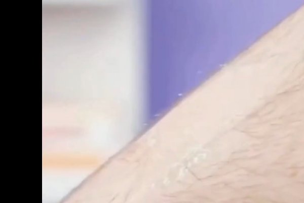 男士脱毛方法;不知道用什么啊?