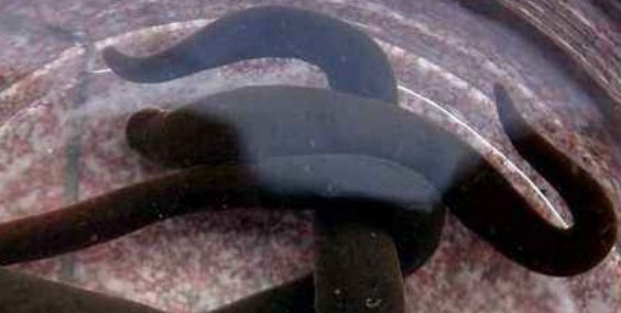 被液氮冷冻24小时之(-196℃)解冻后的扬子鳃蛭为什么依然活蹦乱跳?