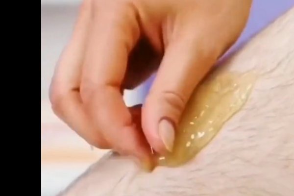 男士脱毛方法;不知道用什么啊?