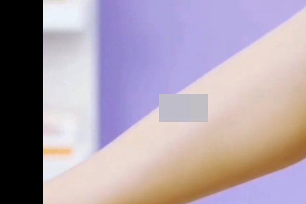 男士脱毛方法;不知道用什么啊?