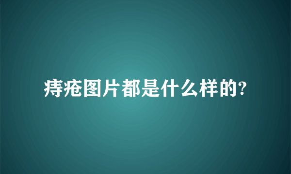 痔疮图片都是什么样的?