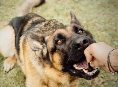 湖北一男子被恶狗咬伤后徒手直接将狗掐死，狗主人需要承担哪些责任？