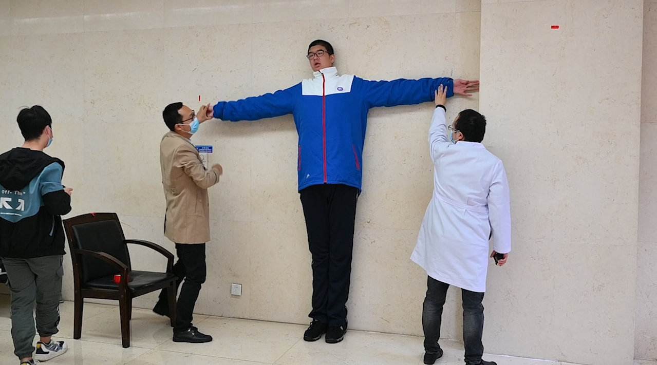 四川14岁男孩身高创吉尼斯记录,身高对他的生活带来了哪些影响?
