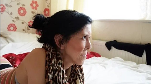 河南少女得怪病，面容衰老如7旬老太，这是怎么回事？