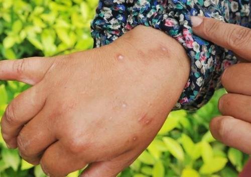 红火蚁入侵全国12省份435个县,它是如何传播的?