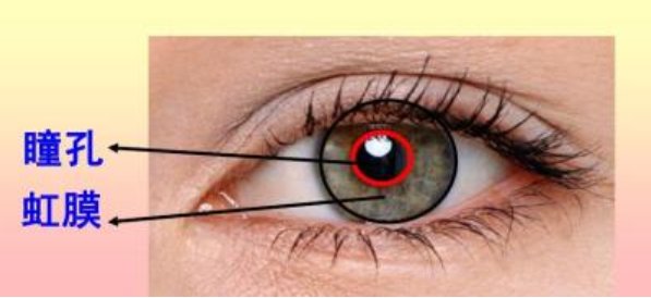 什么是虹膜炎